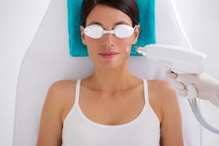 erbium-laser-facial-resurfacing